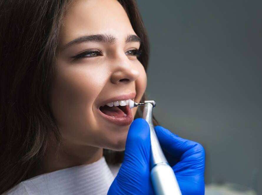 5 Main Steps Involved in a Professional Dental Clean